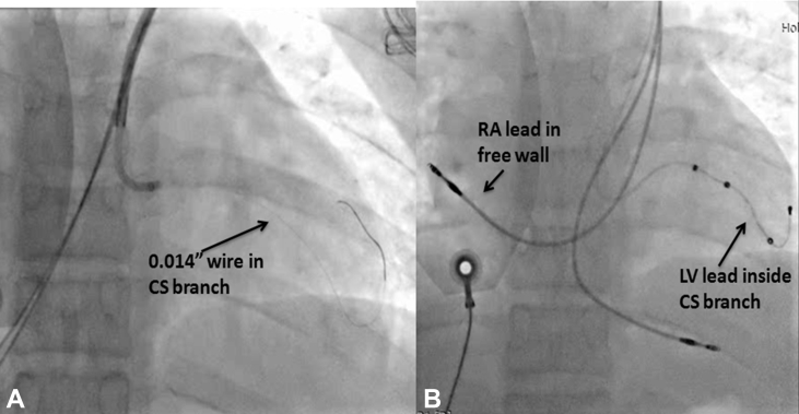 Fig. 2