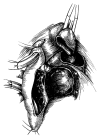 Biatrial technique for the recipient’s cardiectomy