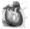 Aorta and pulmonary artery anastomosis for bicaval technique