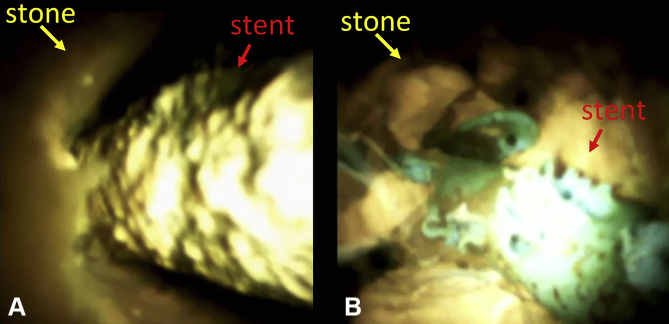 Figure 3