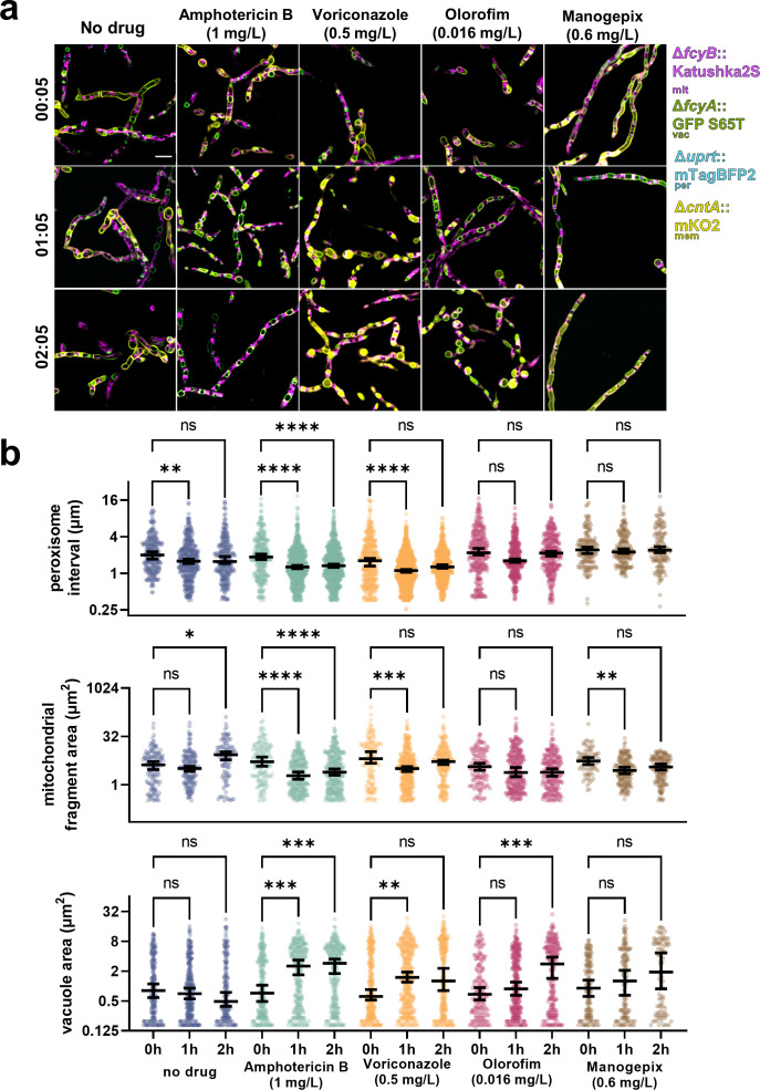 Microscopy of fungal cells treated with antifungal drugs at different time points and scatterplots quantifying peroxisome intervals, mitochondrial fragment area, and vacuole area under drug treatments.