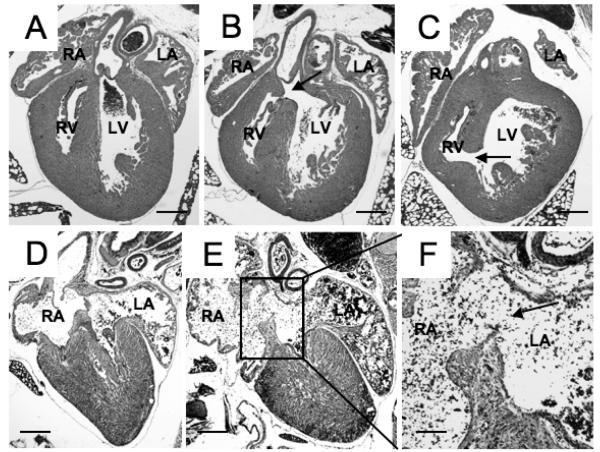 Figure. 3