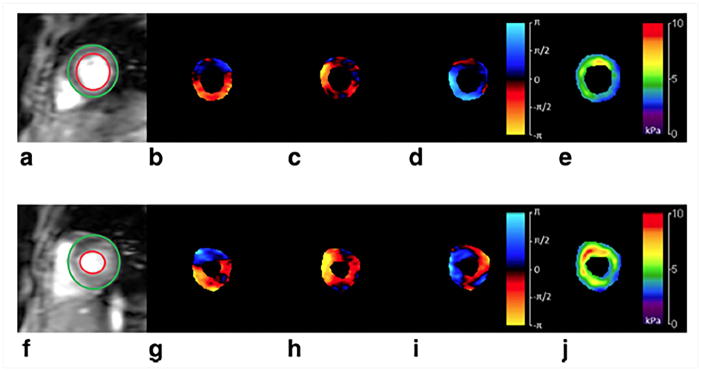 Figure 13