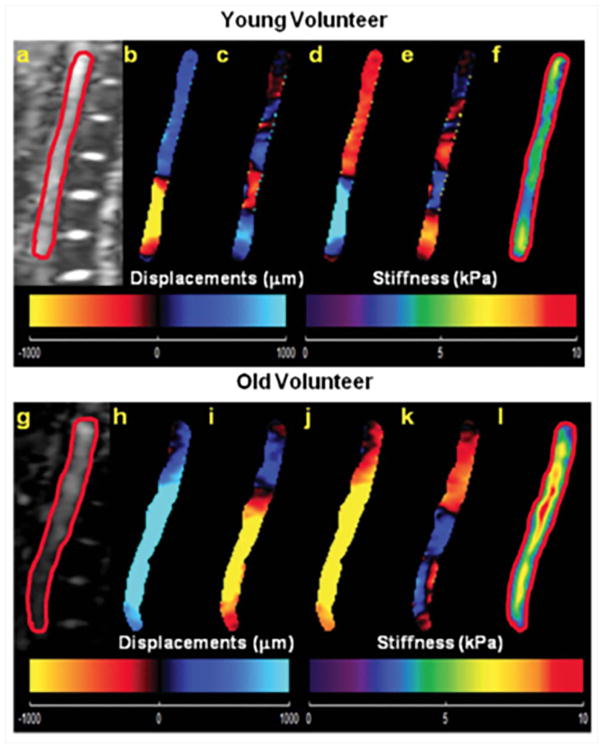 Figure 20