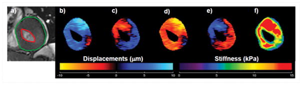 Figure 16