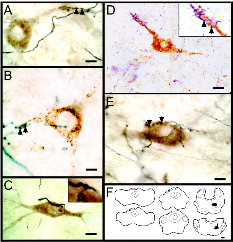 Figure 11.