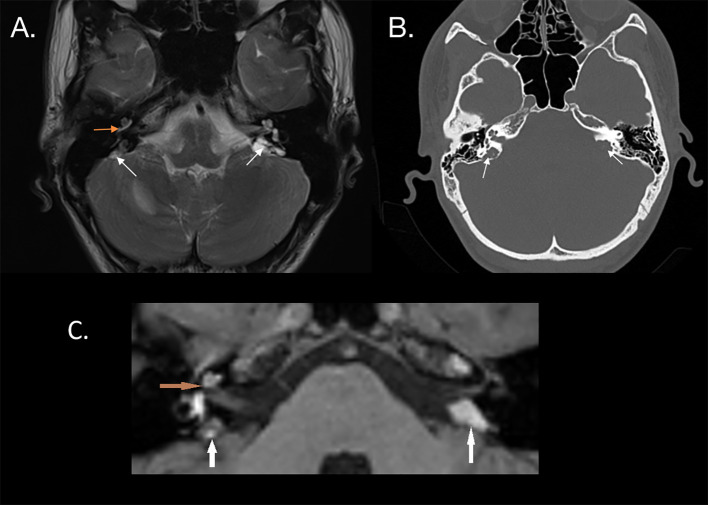 Figure 2