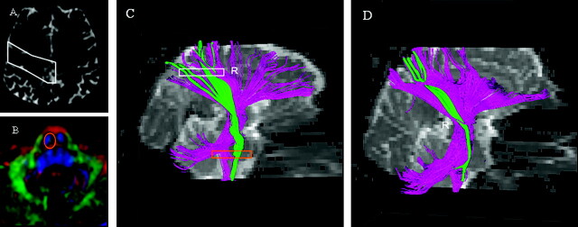 Fig 3.