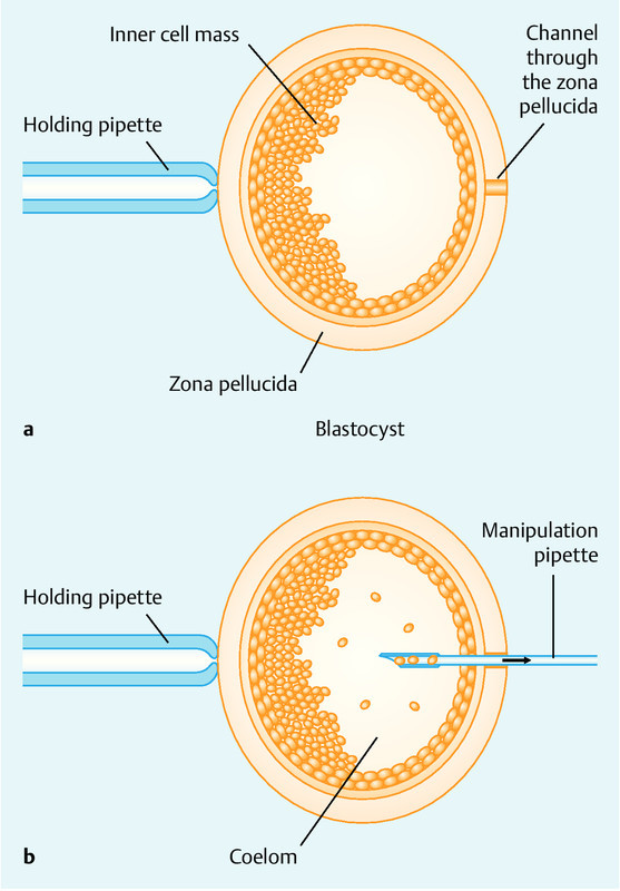 Fig. 1 a