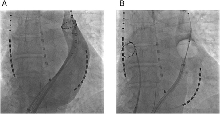 Fig. 2