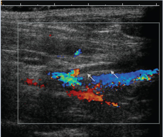 graphic file with name 10.1016_j.jfms.2009.01.003-fig9.jpg