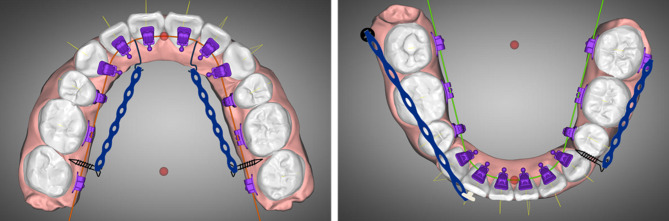 Fig. 9