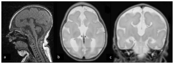 Figure 1abc