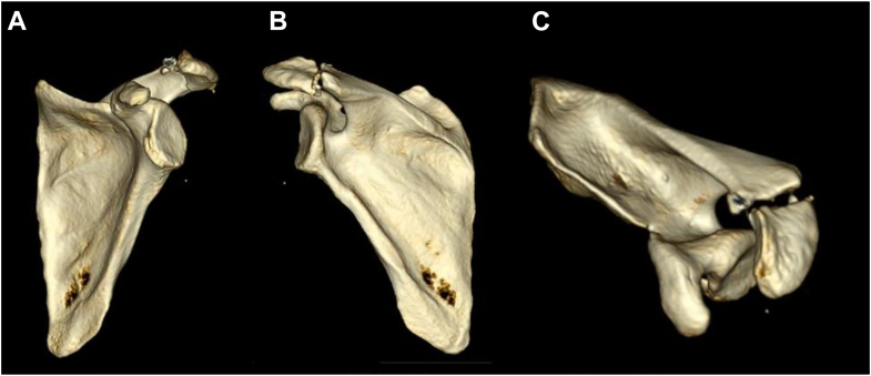 Figure 2