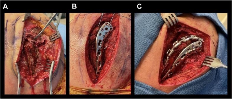 Figure 6