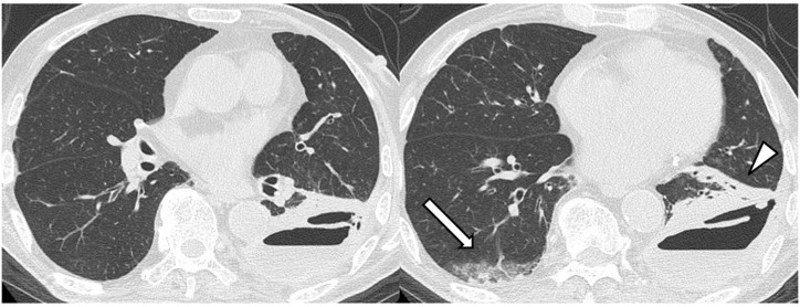 Fig. 5