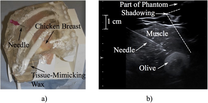 Fig 3