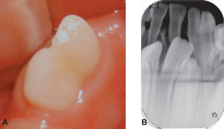 Figure 3A-B