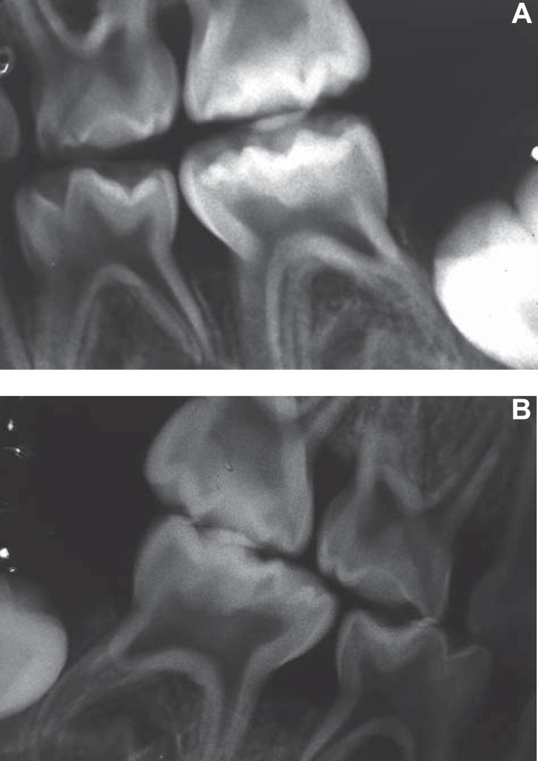 Figure 5A-B