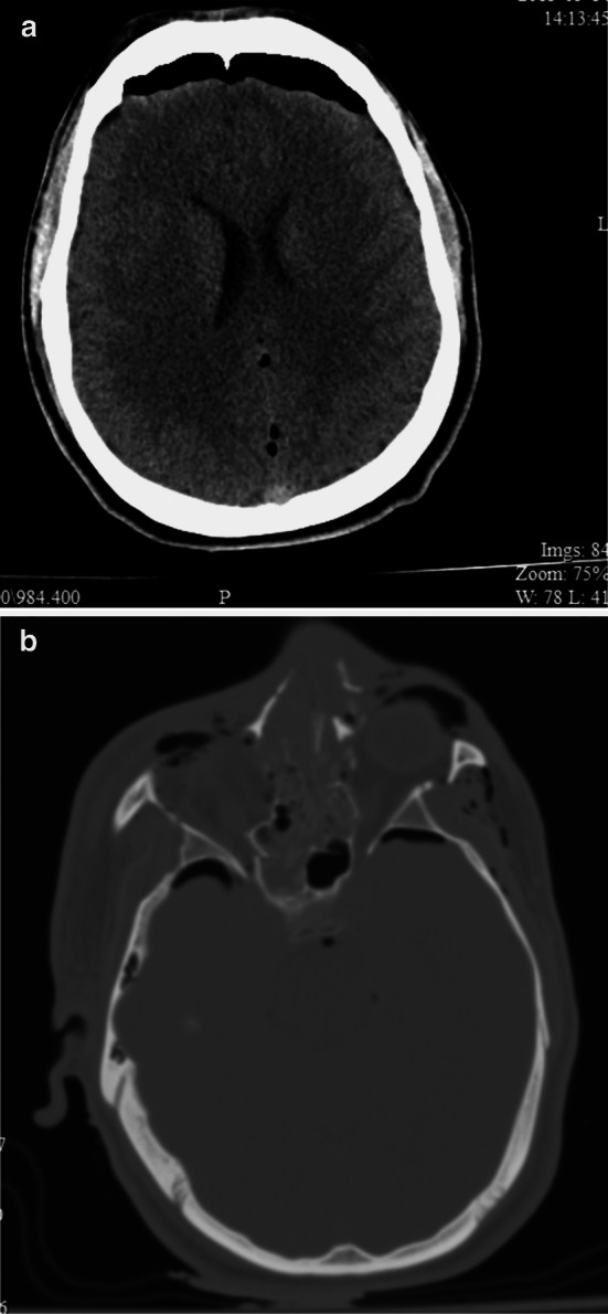 Fig. 4