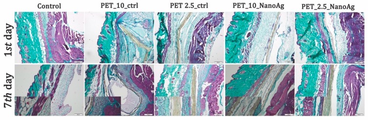 Figure 14