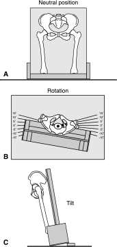 Fig. 1A–C