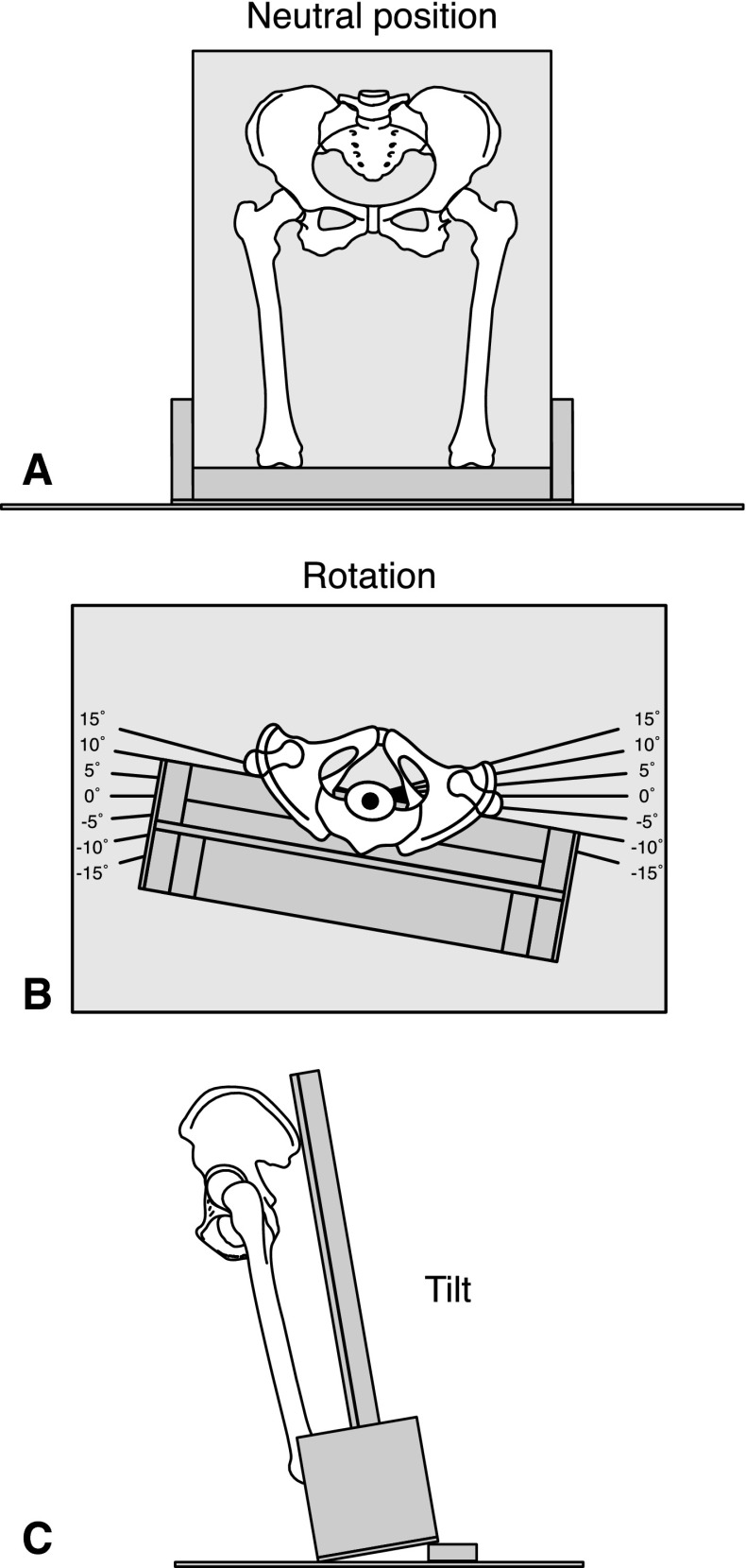 Fig. 1A–C