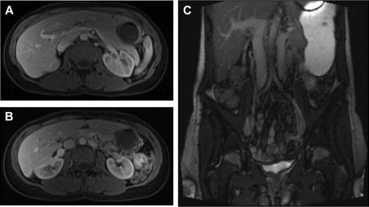 Fig 1