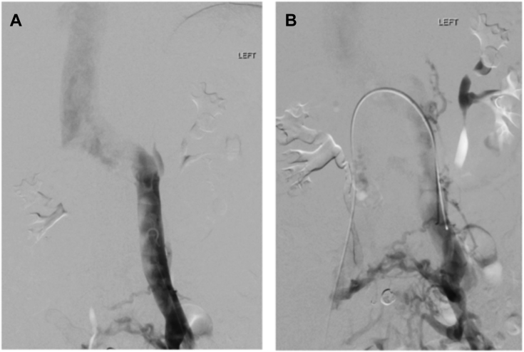 Fig 2