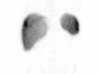 Rotating Image