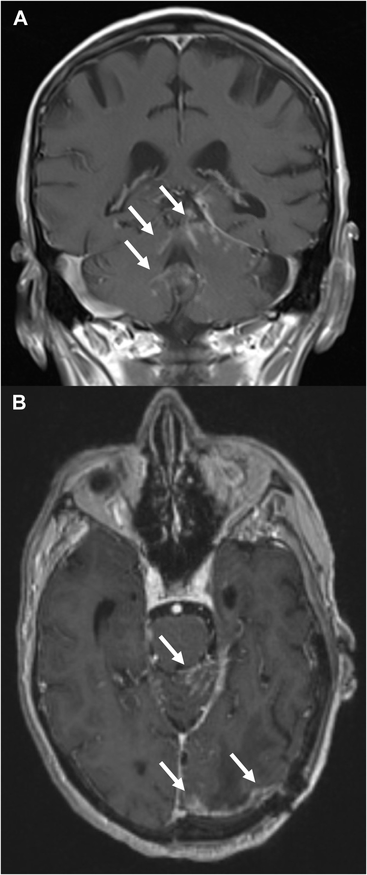 Figure 2