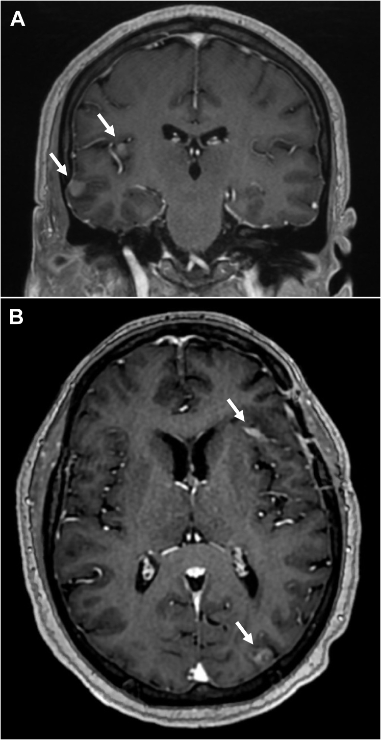 Figure 1