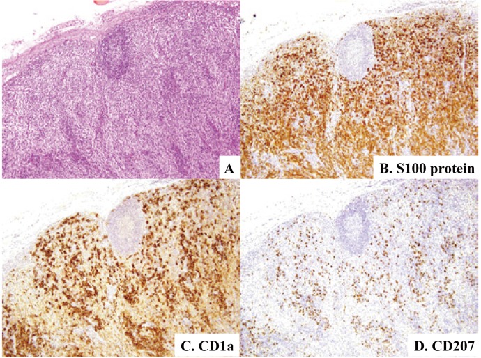 Fig. 11