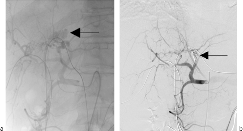 Fig. 12