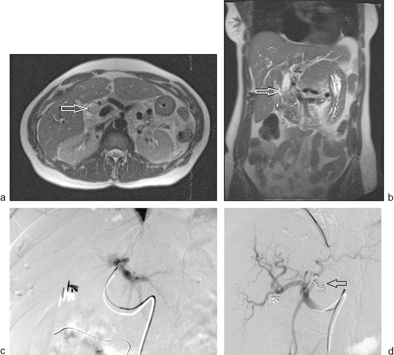 Fig. 16