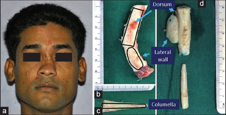 Figure 15