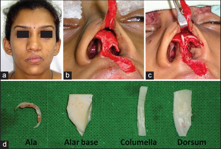 Figure 22