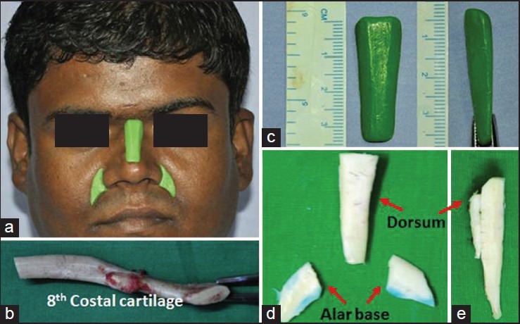 Figure 19