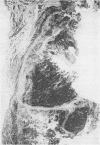 95