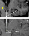 Fig. 4