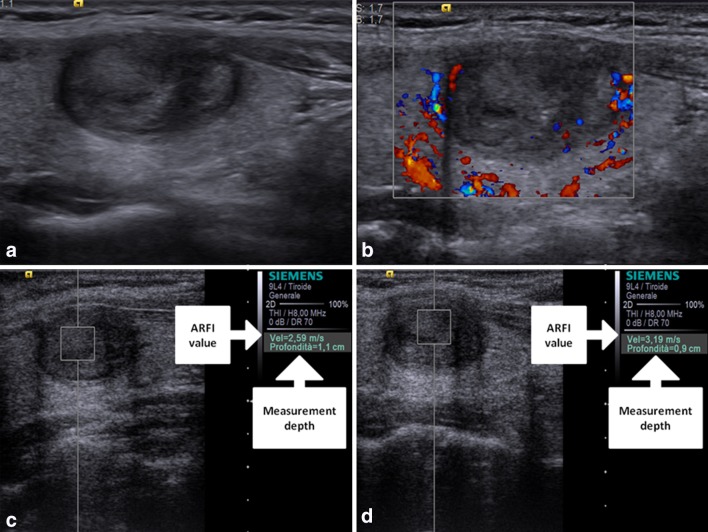 Fig. 4