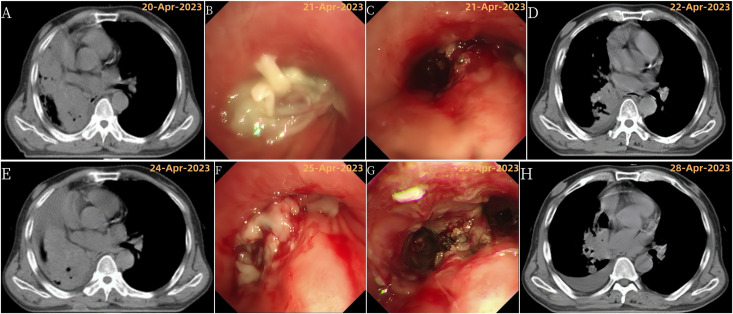 Figure 3