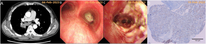 Figure 2