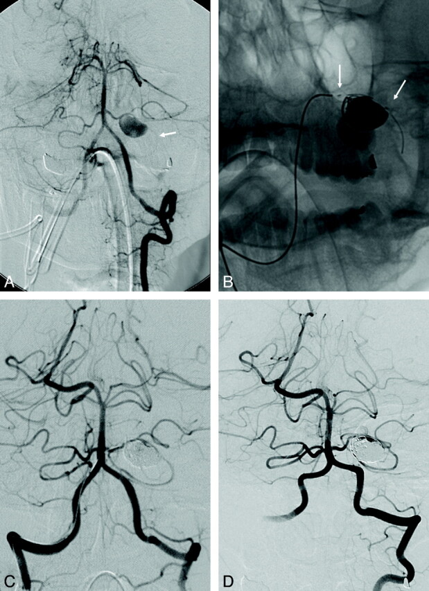 Fig 1.