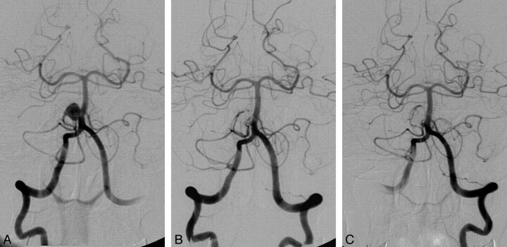 Fig 2.