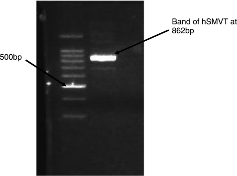 FIG. 11.