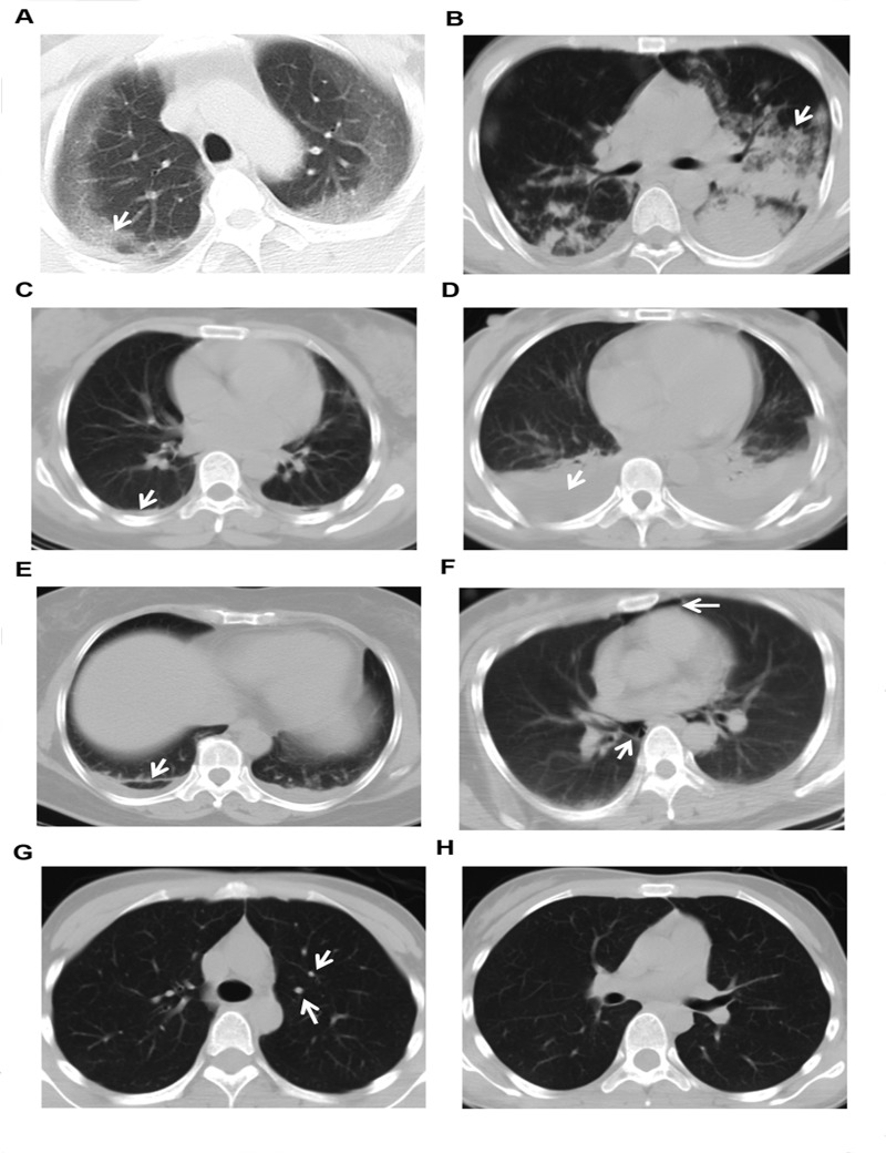 Fig 2