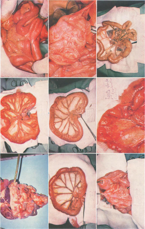 Fig. 1., Fig. 2A., Fig. 2B., Fig. 3A., Fig. 3B., Fig. 4A and 4B., Fig. 4C and 4D.