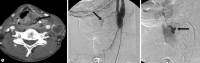 Fig. 11.
