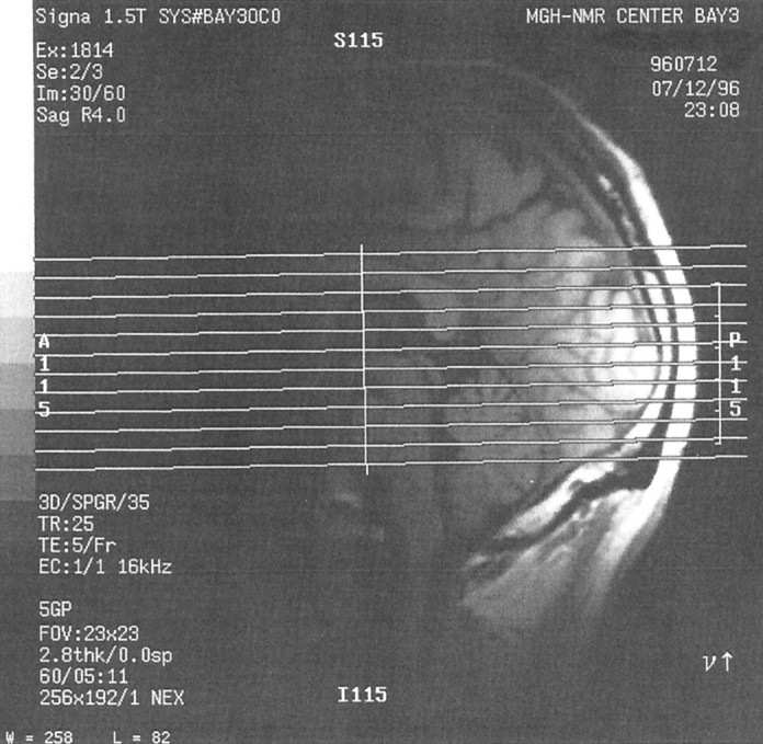 Fig. 5.